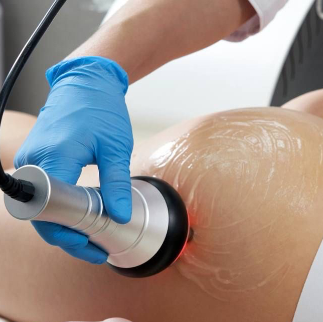 RF лифтинг из 10 процедур