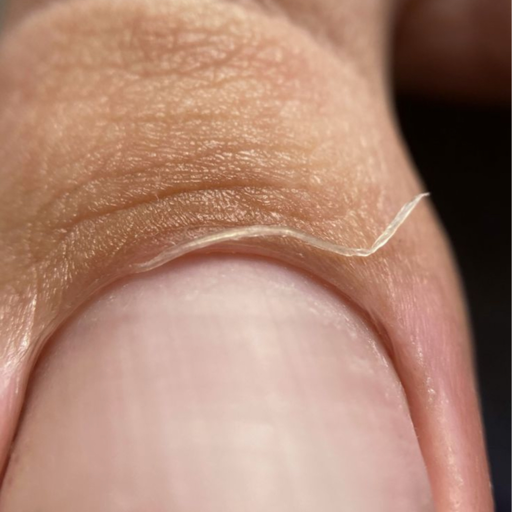 ПЕДИКЮР МУЖСКОЙ ПАЛЬЧИКИ