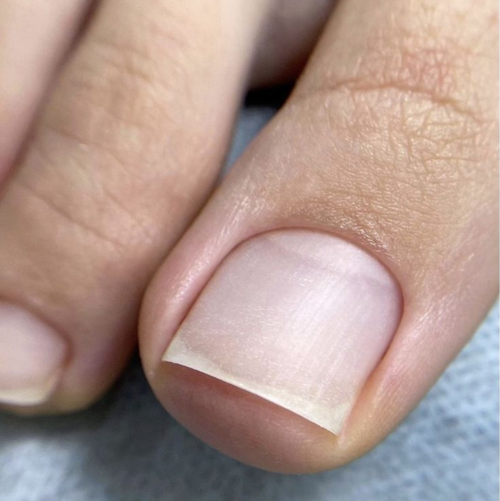 ПЕДИКЮР ПАЛЬЧИКИ