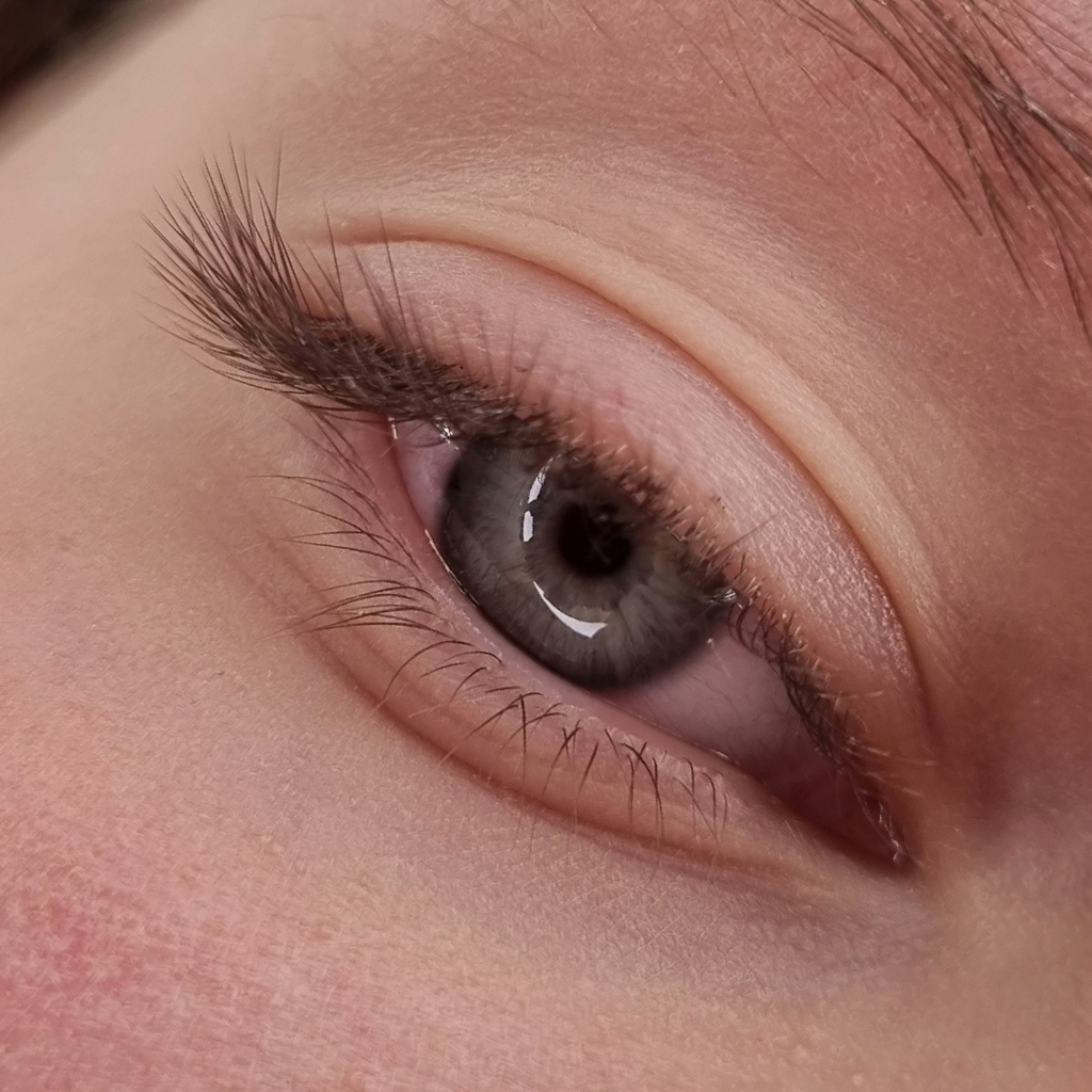 Уголки( неполное наращивание)