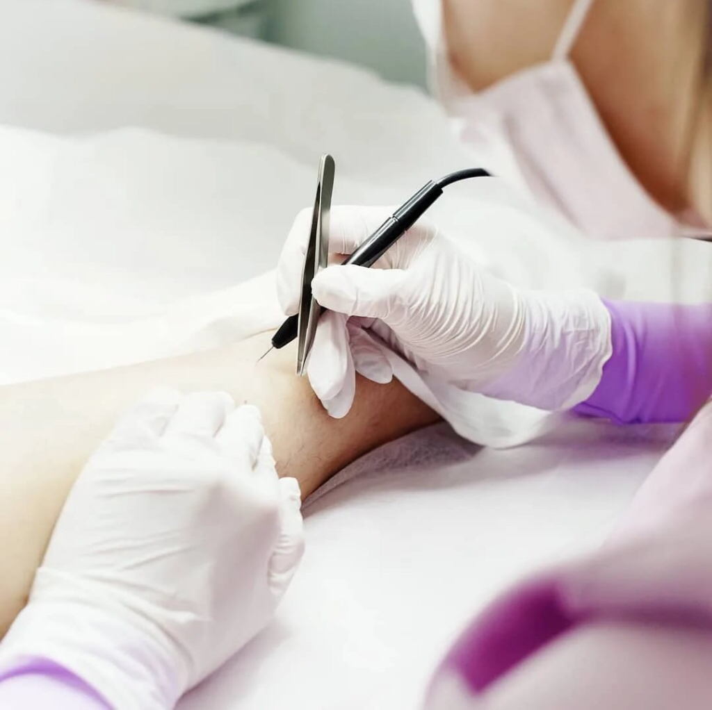 Пробный сеанс (15 мин. без анестезии)