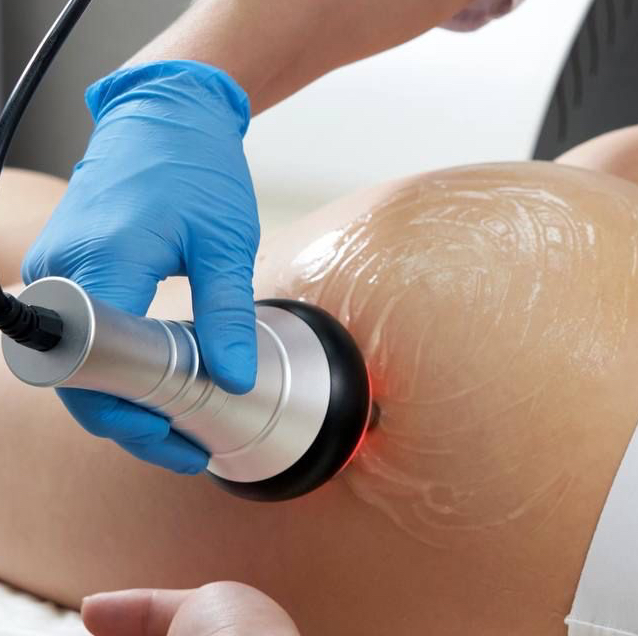 RF-лифтинг тела