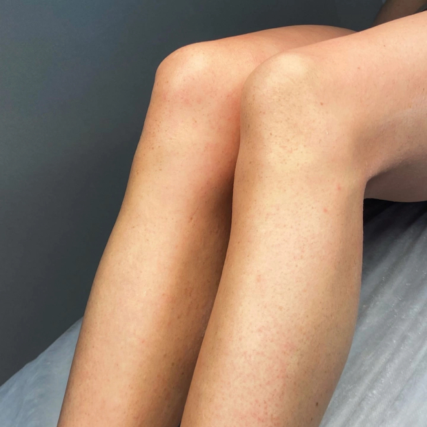 Ноги полностью