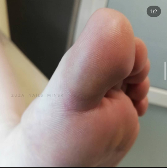 SMART-педикюр: вкл обработка пальчиков и стоп / нанесение лечебного покрытия