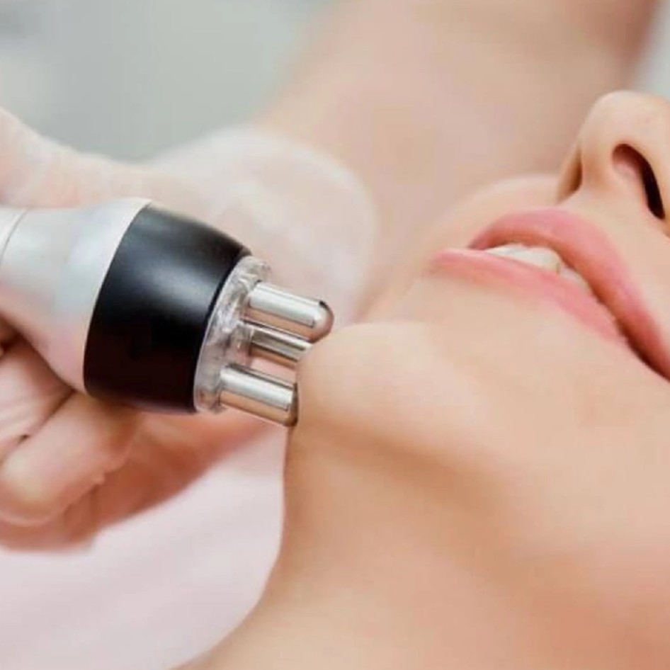 rf-лифтинг шея