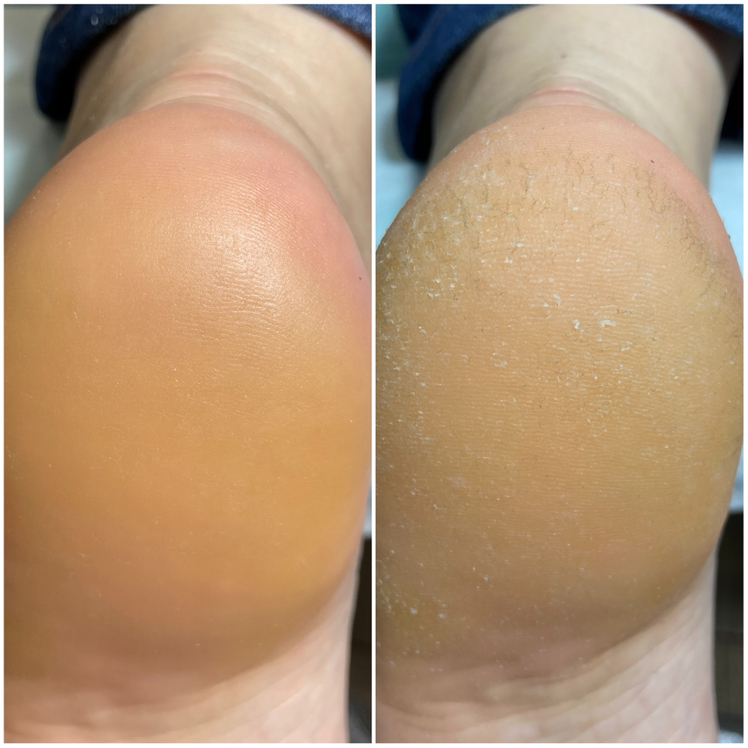 Педикюр / стопа + пальчики без покрытия