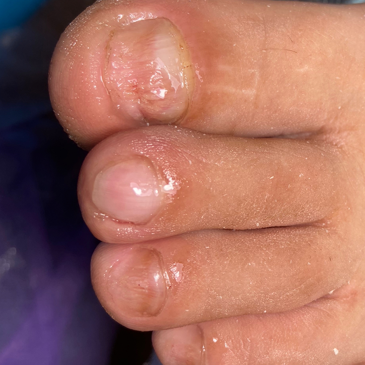 Комплекс педикюрных услуг для сложной стопы (ногти)