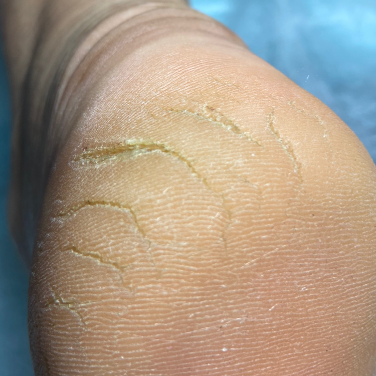 Комплекс педикюрных услуг для сложной стопы ( ногти+подошвы)