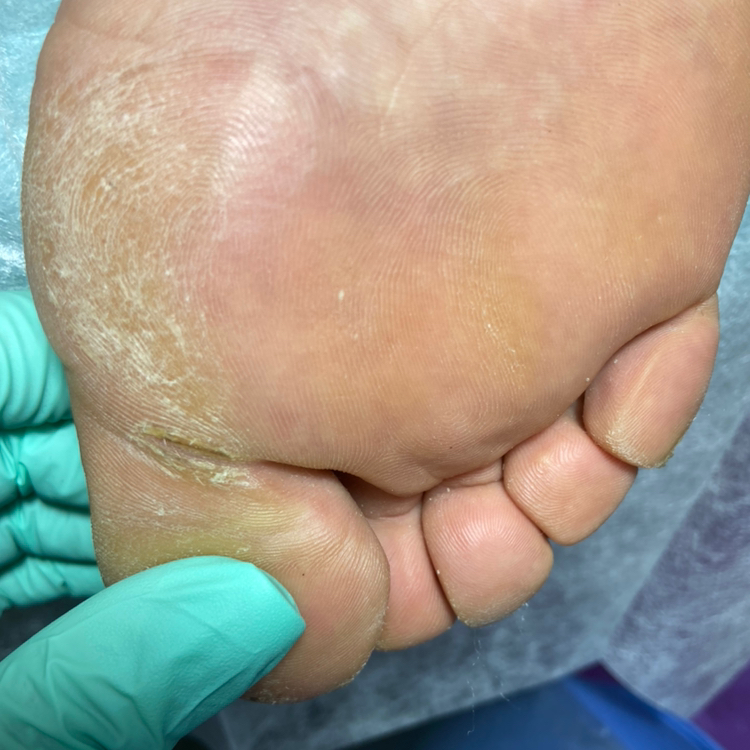 Комплекс педикюрных услуг для сложной стопы (подошвы)