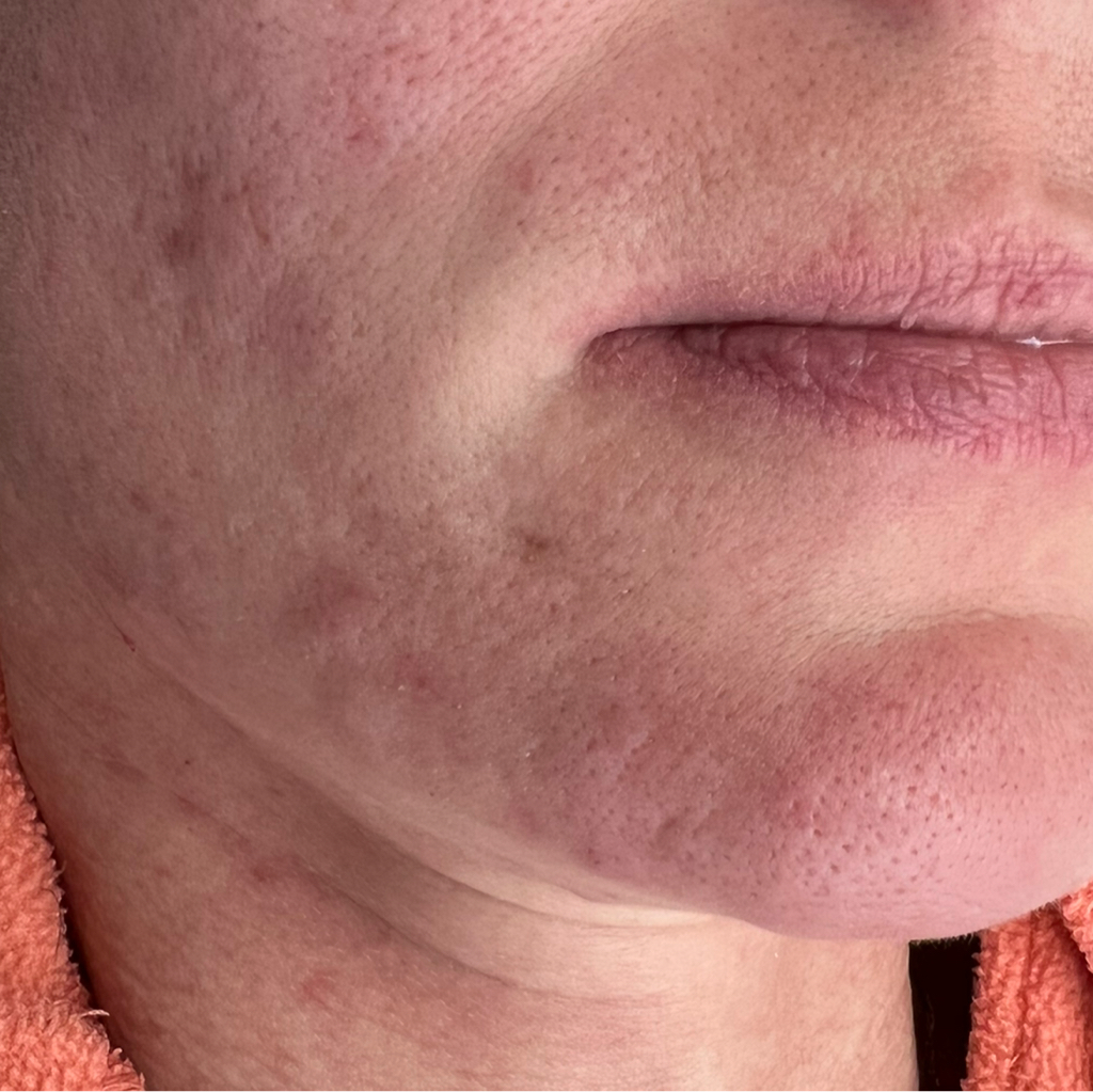 Чистка лица - комплекс PLEYANA 25+