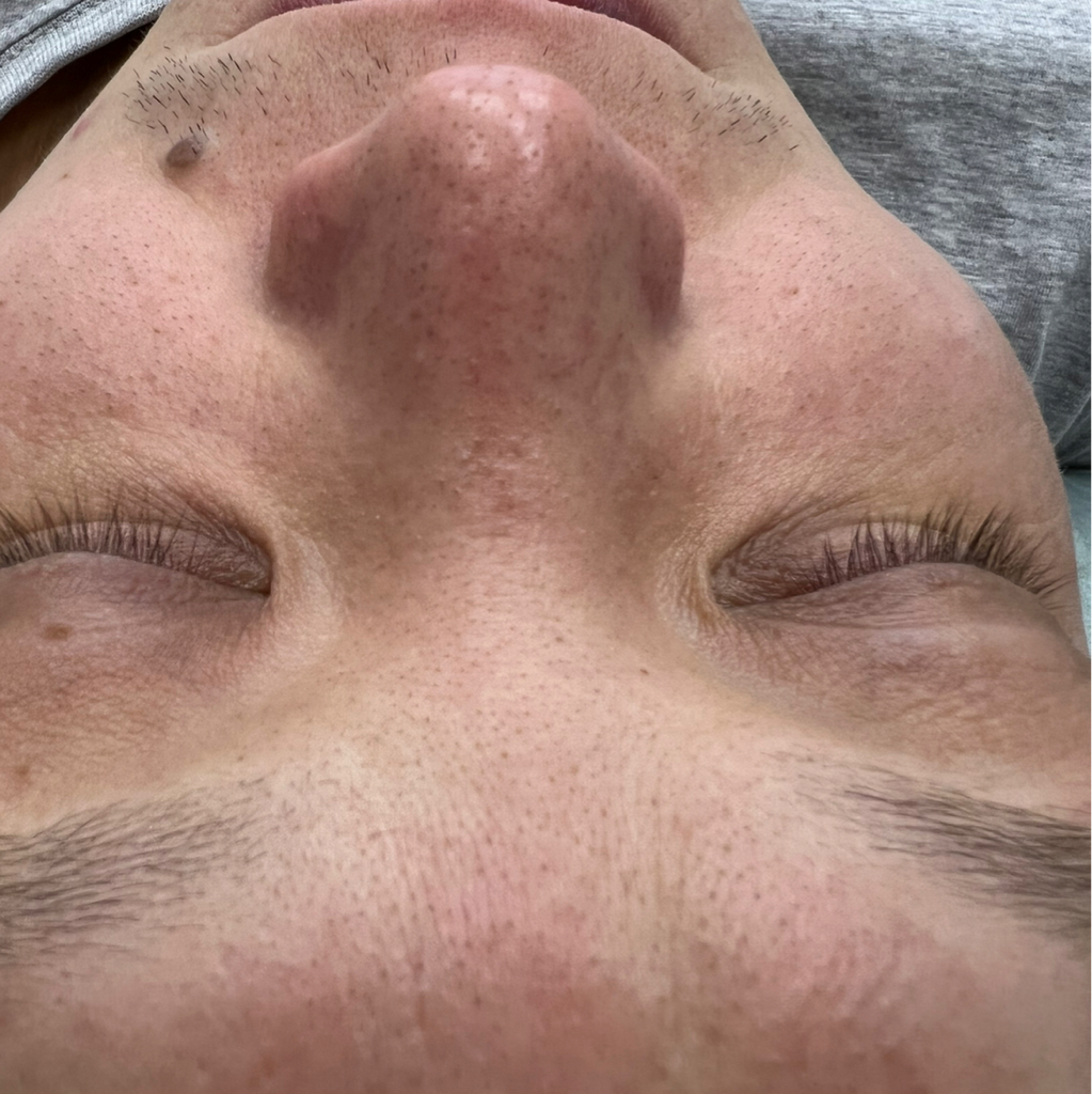 Глубокая чистка лица Ph formula