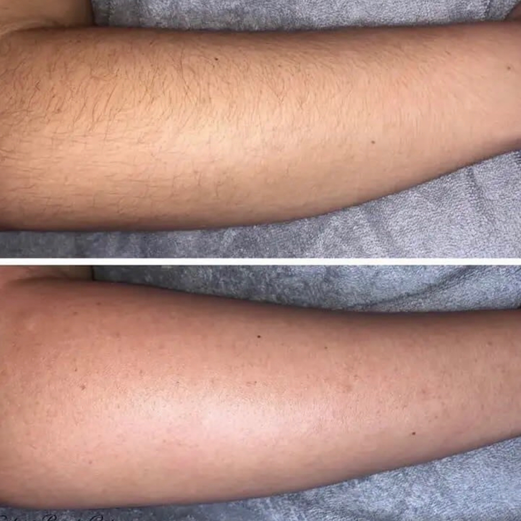 Руки полностью