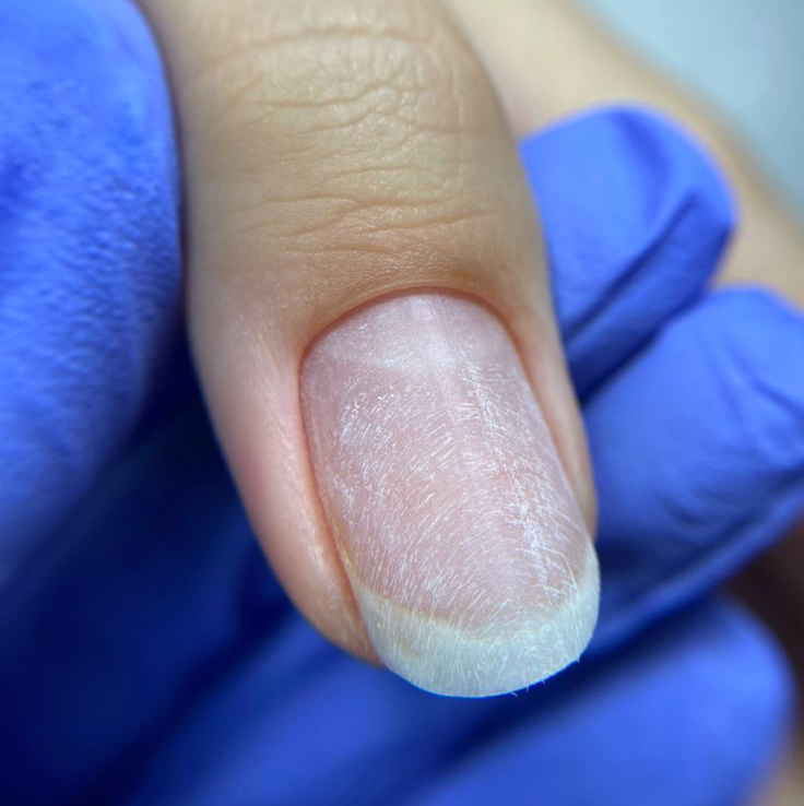 Комбинированный маникюр  без покрытия + опил формы