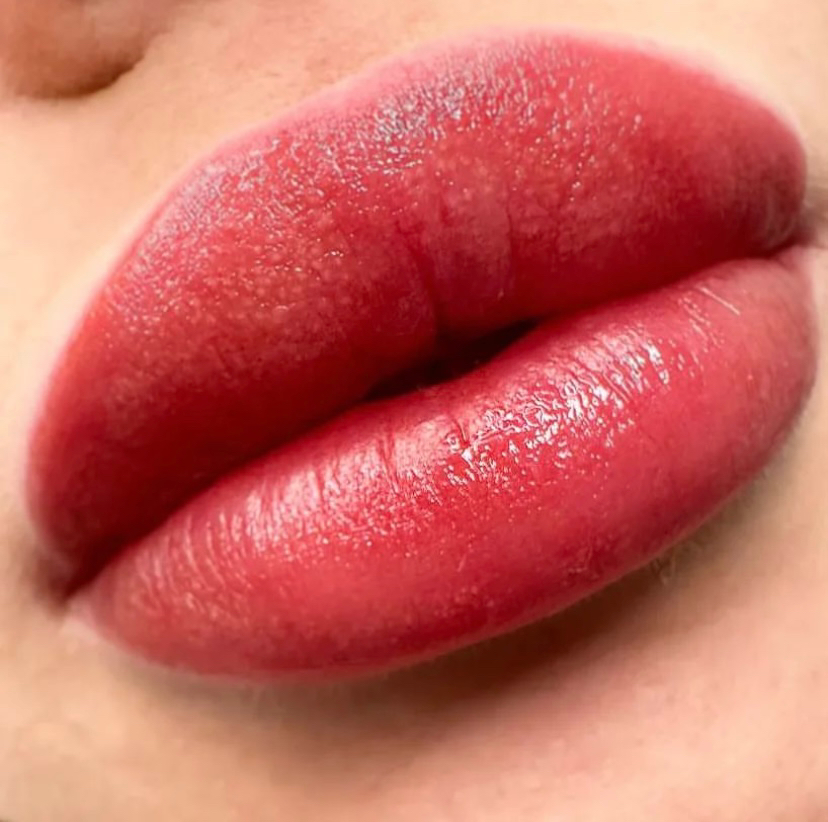 Коррекция ПМ (через 1-2месяца)