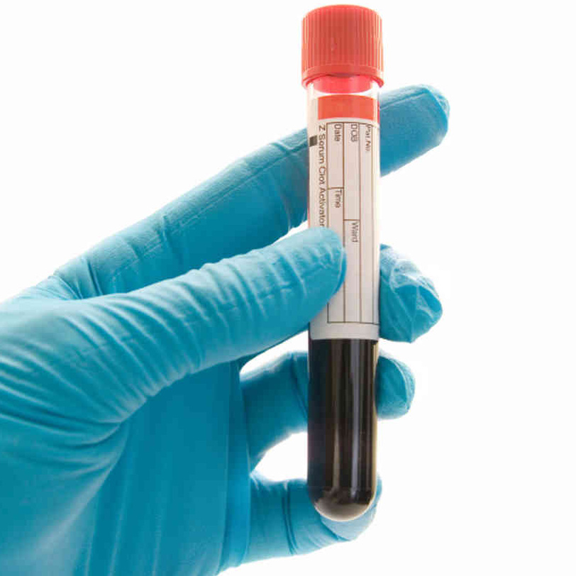 Биохимический анализ крови