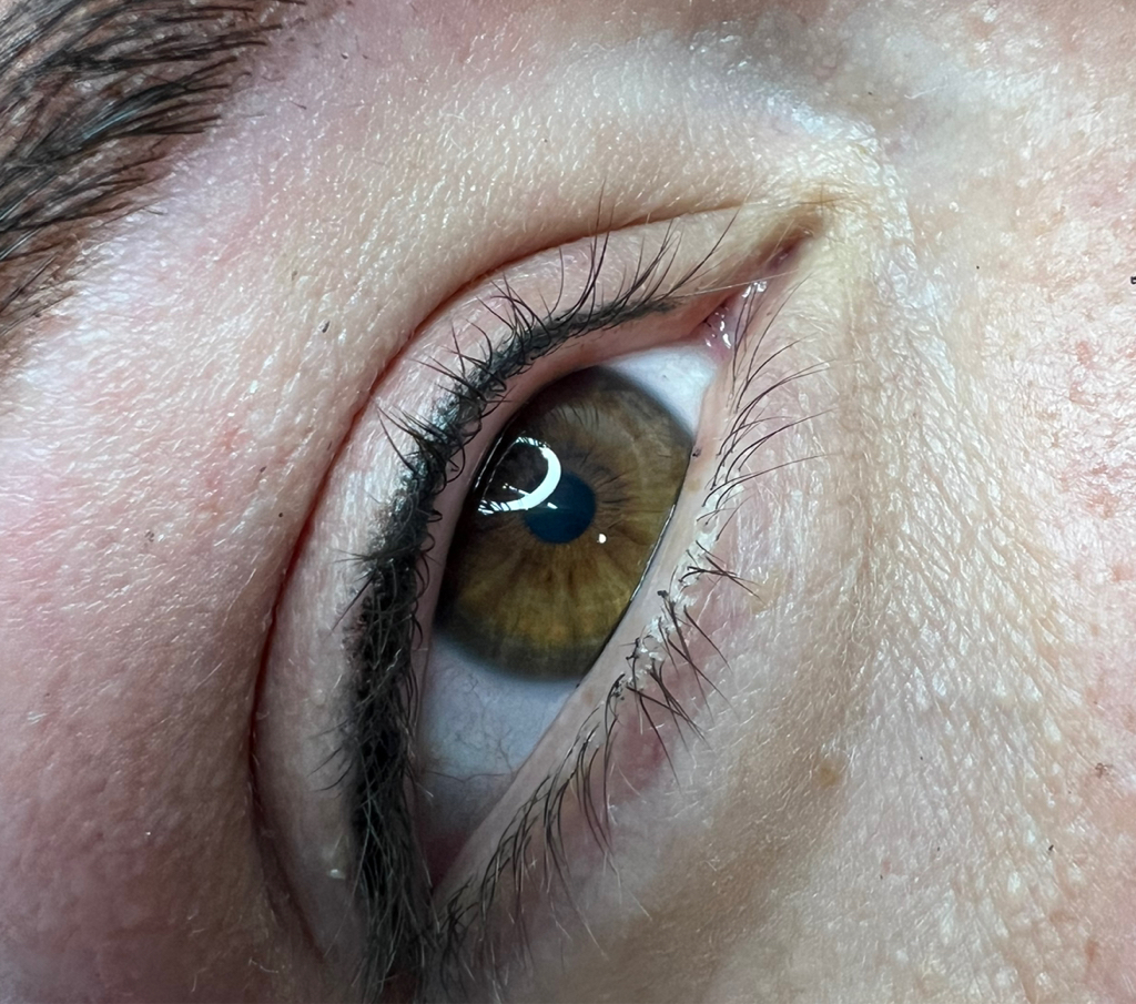 Межресничка