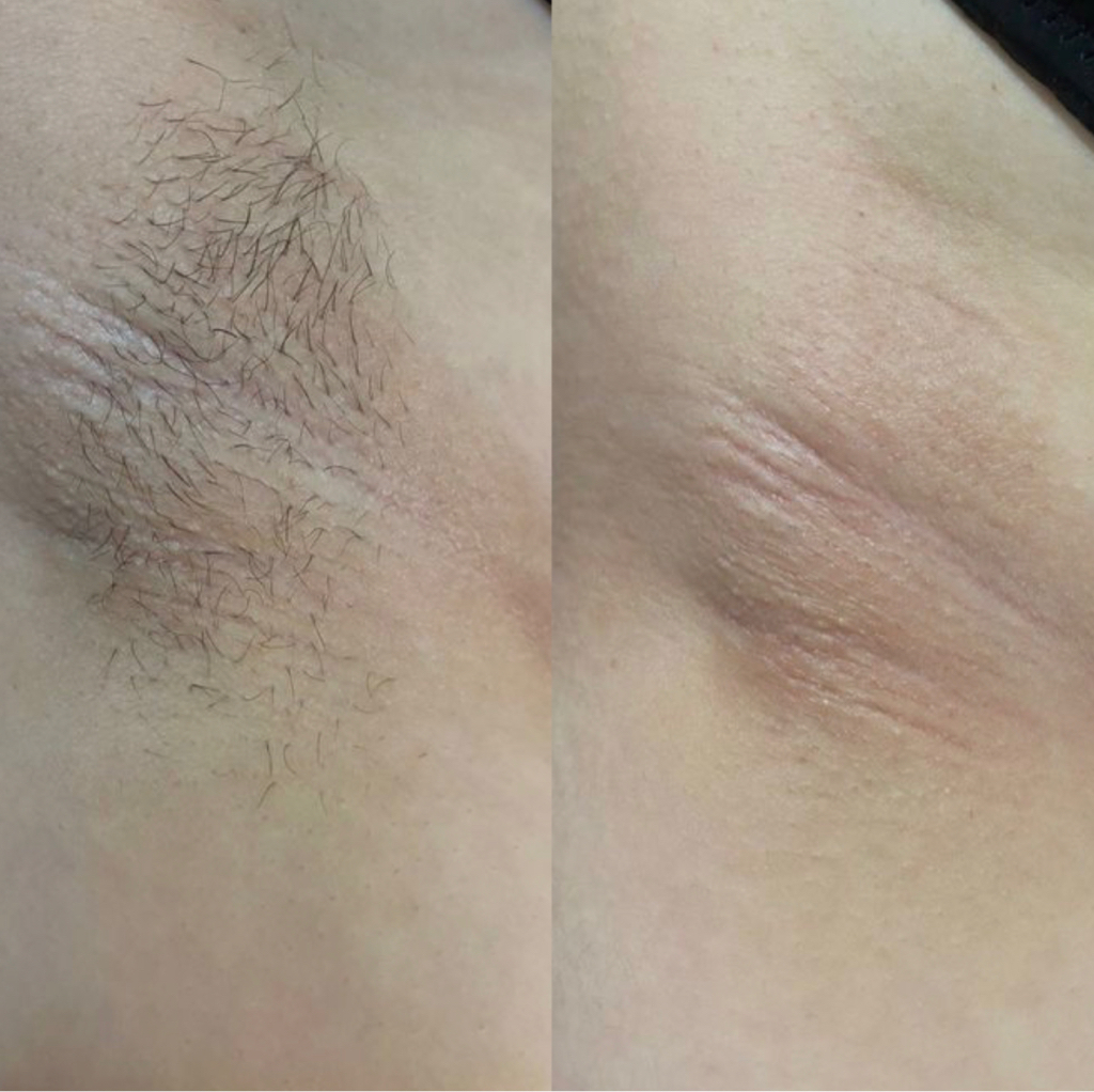 Воск бикини + подмышки