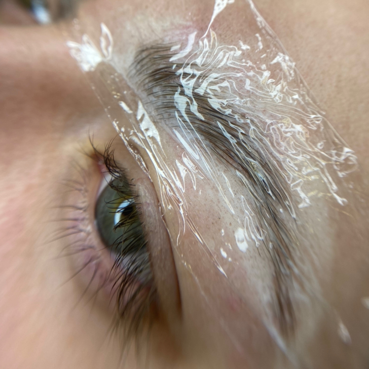 Ботокс для бровей