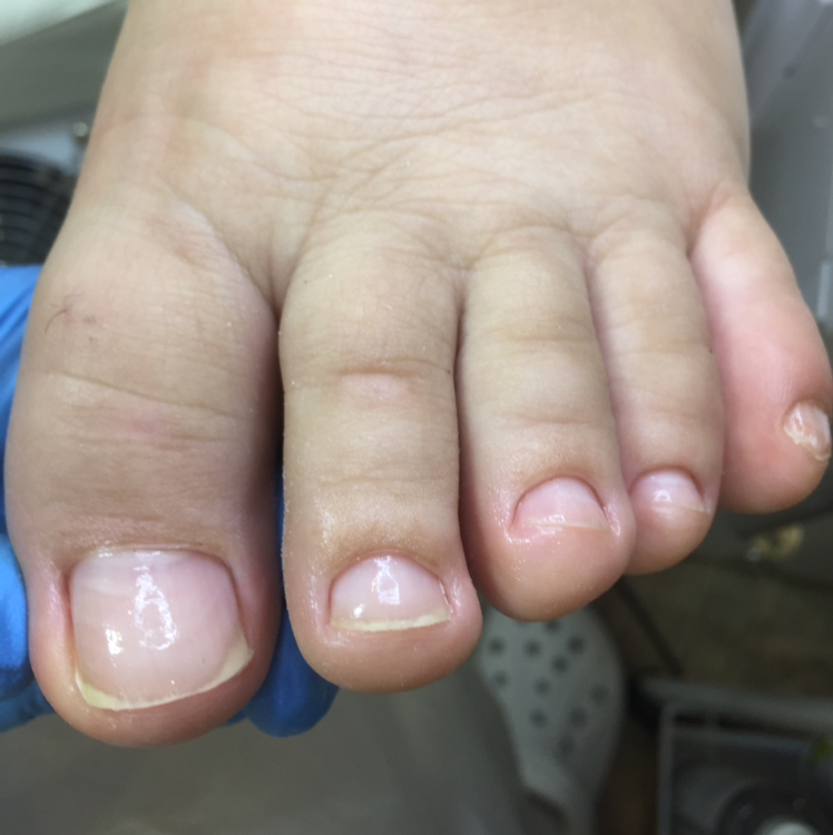 Педикюр пальцев без покрытия