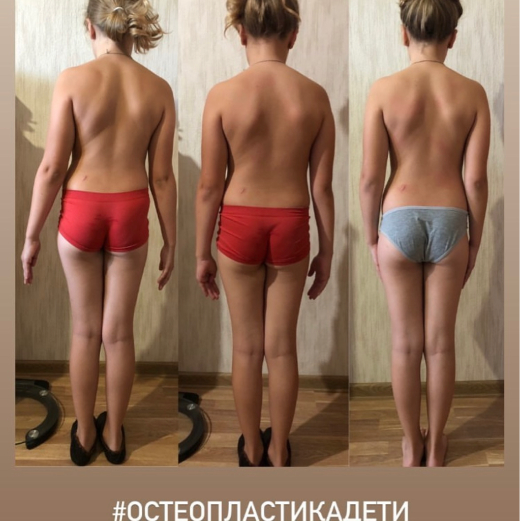 Функциональная коррекция  дети 0-12 лет