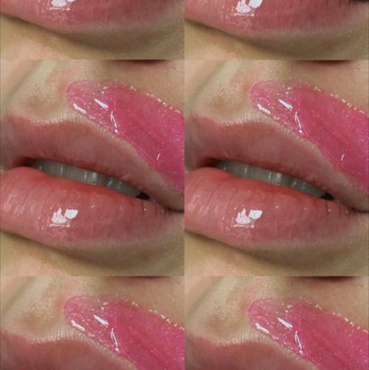 Удаление лишних волосков на лице