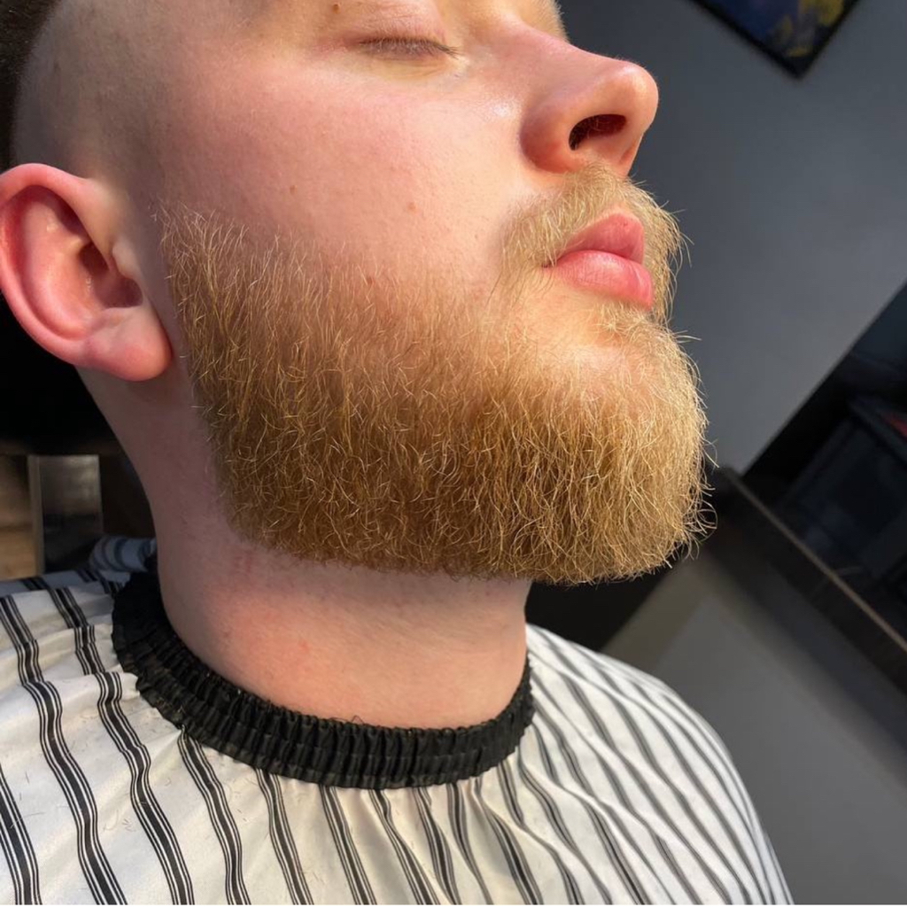 Корекція бороди - Beard correction