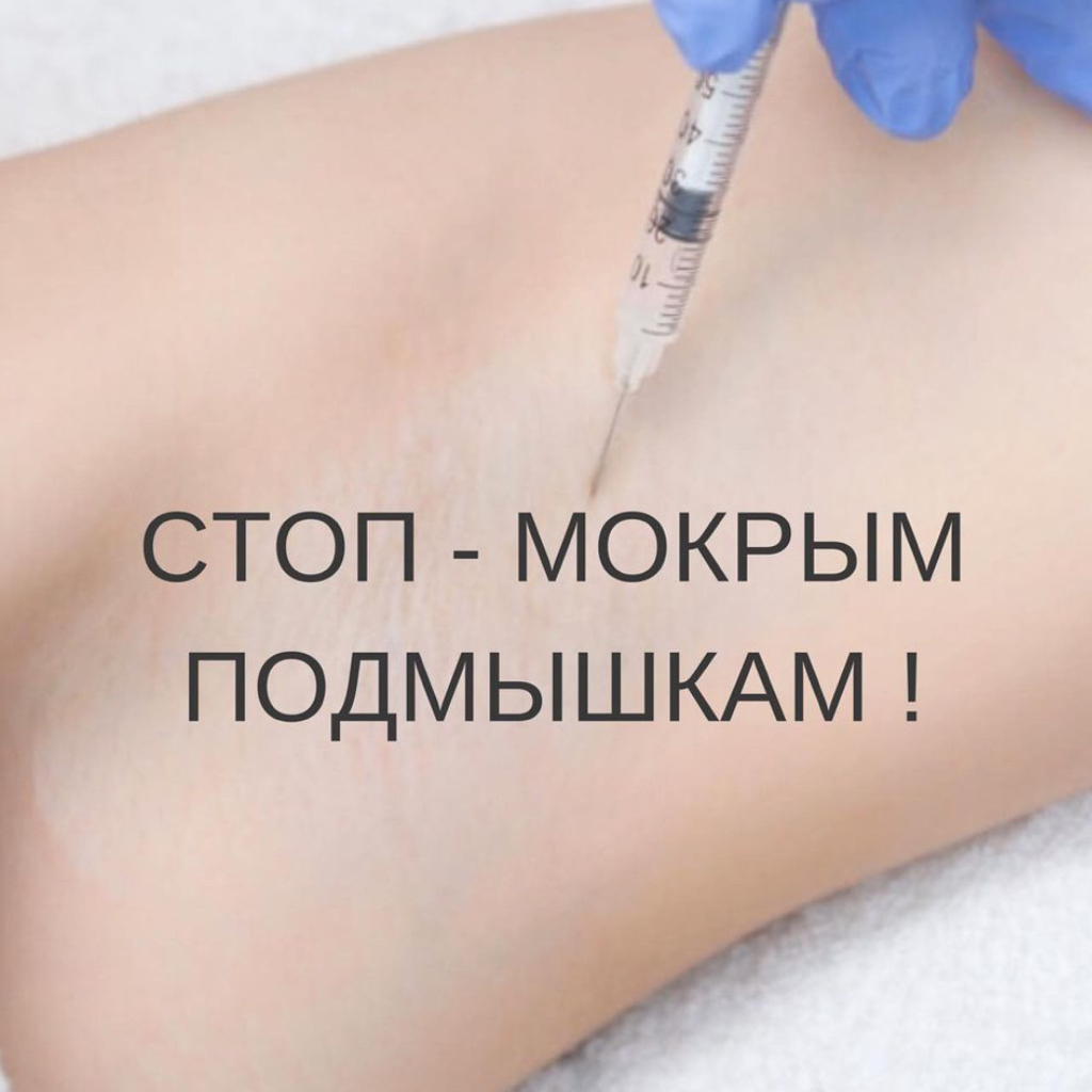 Лечение гипергидроза (Повышенной потливости)