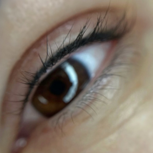 Межресничное пространство