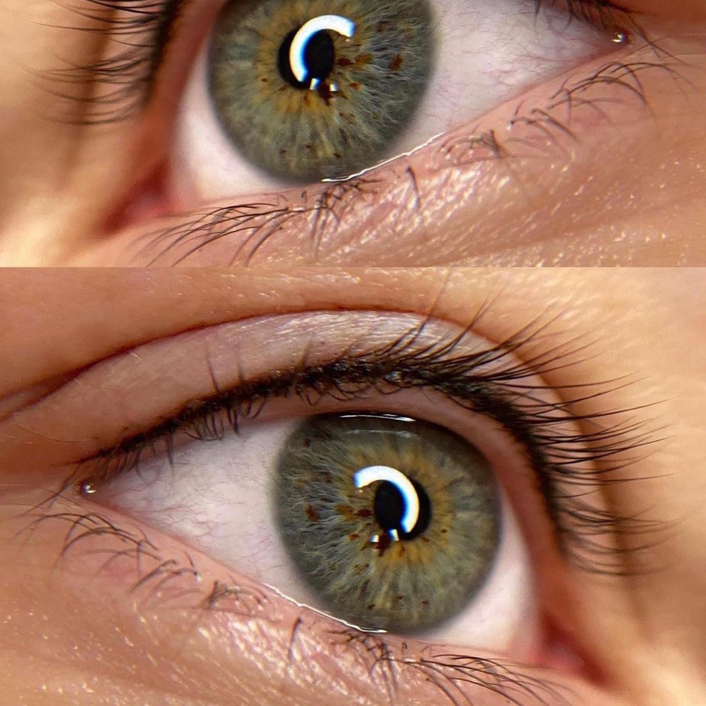 Перманент межреснички